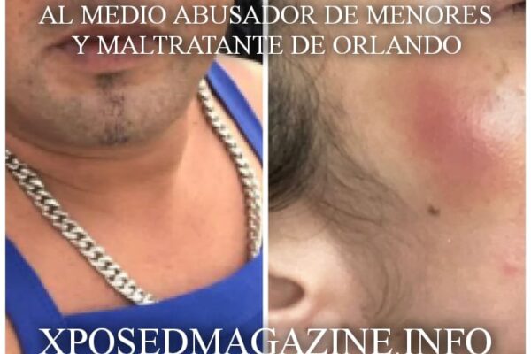AL MEDIO ABUSADOR DE MENORES Y MALTRATANTE DE ORLANDO