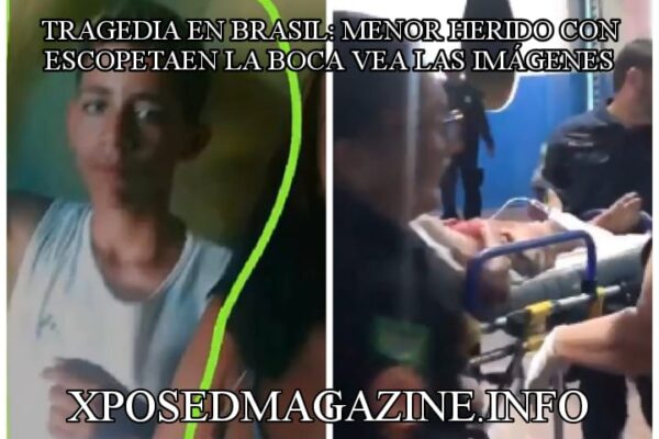 TRAGEDIA EN BRASIL: MENOR HERIDO CON ESCOPETAEN LA BOCA VEA LAS IMÁGENES