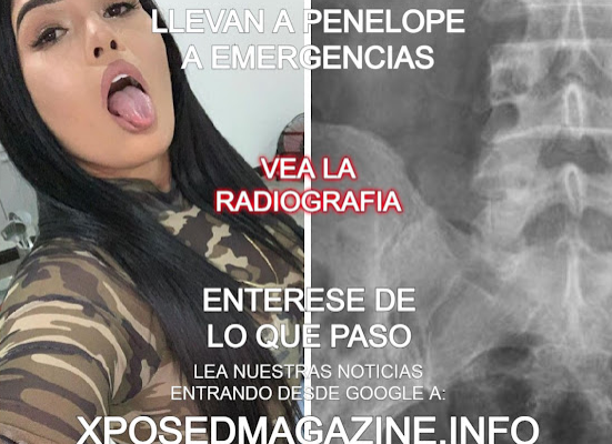 LLEVAN A PENELOPE A EMERGENCIAS ENTERESE DE LO QUE PASO