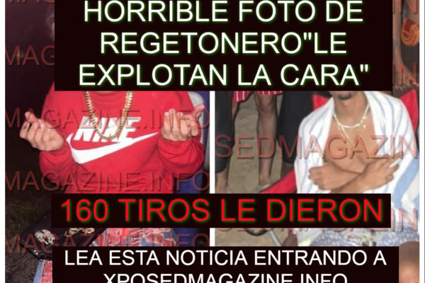 HORRIBLE FOTO DE REGETONERO”LE EXPLOTAN LA CARA”
