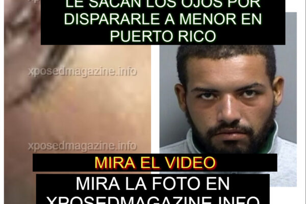 LE SACAN LOS OJOS POR DISPARARLE A MENOR EN PUERTO RICO
